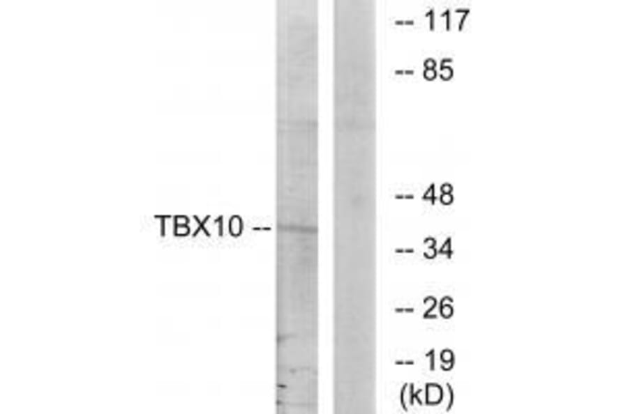 Western blot - TBX10 Antibody from Signalway Antibody (33608) - Antibodies.com