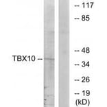 Western blot - TBX10 Antibody from Signalway Antibody (33608) - Antibodies.com