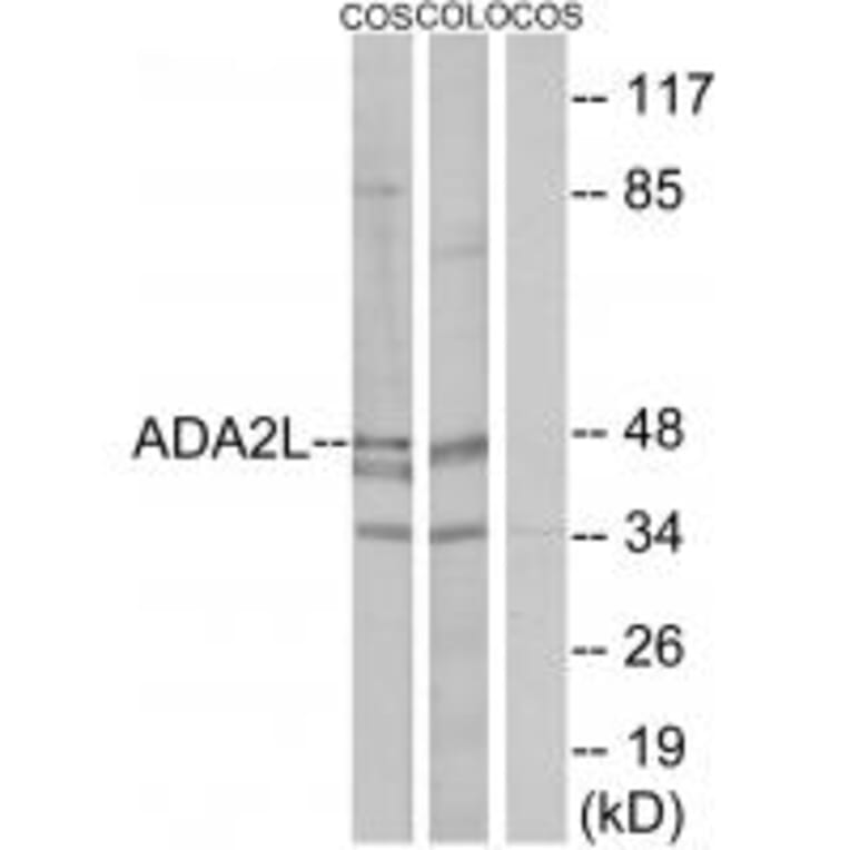 Western blot - ADA2L Antibody from Signalway Antibody (33614) - Antibodies.com