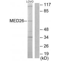 Western blot analysis of extracts from LOVO cells, using MED26 antibody #33633.