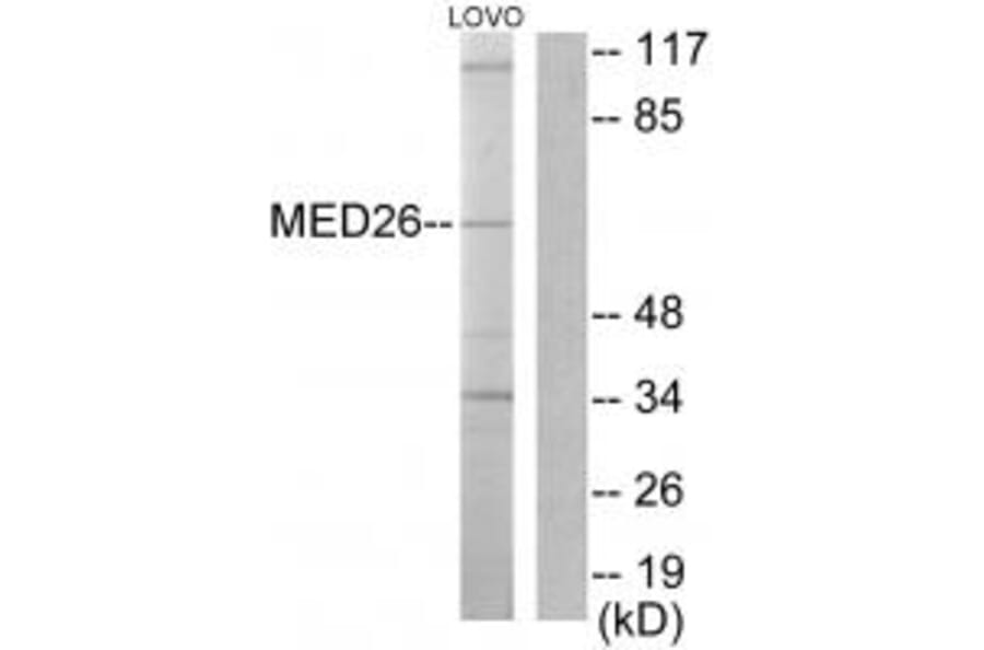 Western blot - MED26 Antibody from Signalway Antibody (33633) - Antibodies.com