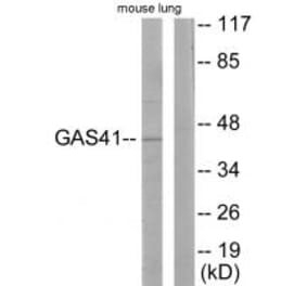 Western blot - GAS41 Antibody from Signalway Antibody (33636) - Antibodies.com