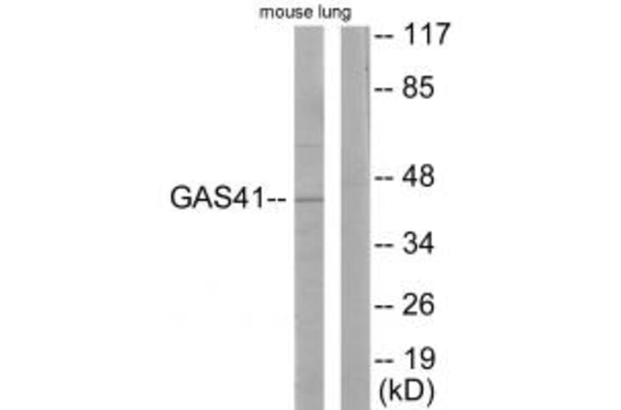 Western blot - GAS41 Antibody from Signalway Antibody (33636) - Antibodies.com