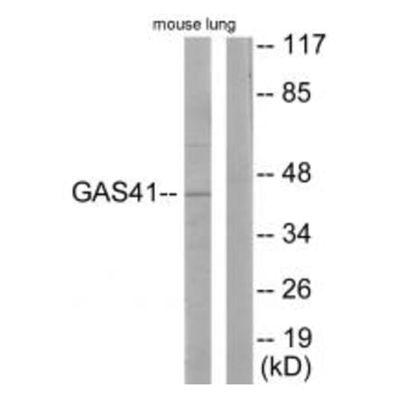 Western blot - GAS41 Antibody from Signalway Antibody (33636) - Antibodies.com