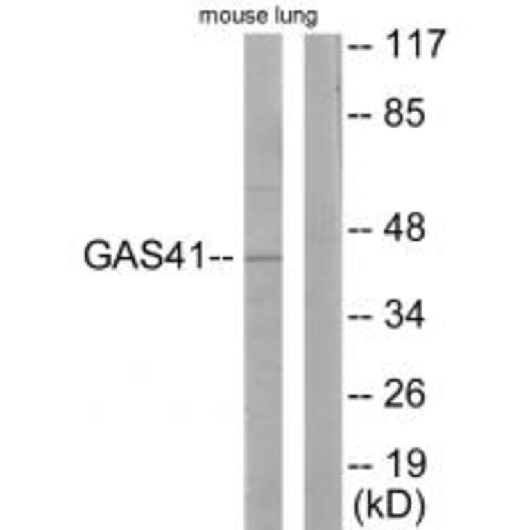 Western blot - GAS41 Antibody from Signalway Antibody (33636) - Antibodies.com