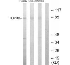 Western blot - TOP3B Antibody from Signalway Antibody (33641) - Antibodies.com