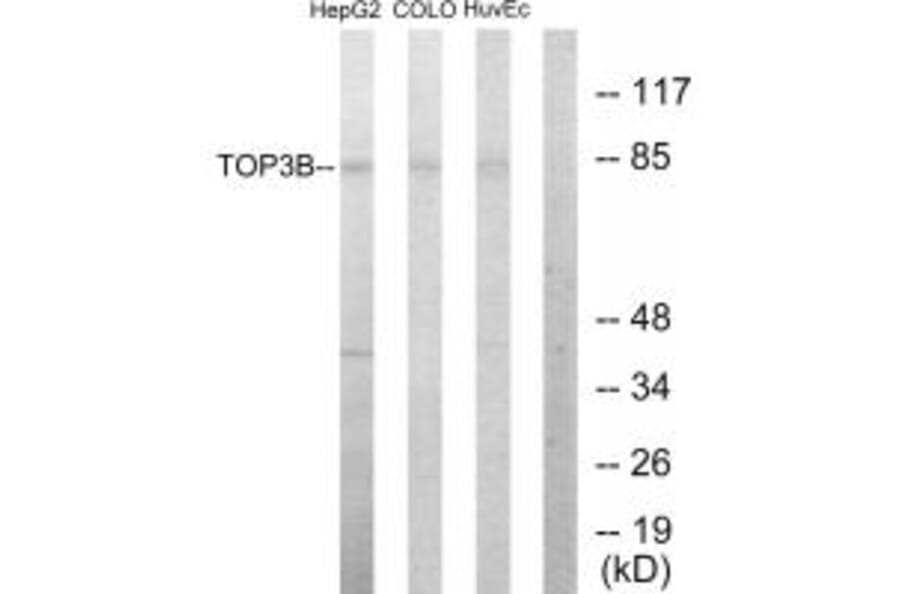 Western blot - TOP3B Antibody from Signalway Antibody (33641) - Antibodies.com