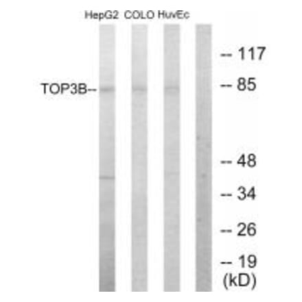 Western blot - TOP3B Antibody from Signalway Antibody (33641) - Antibodies.com