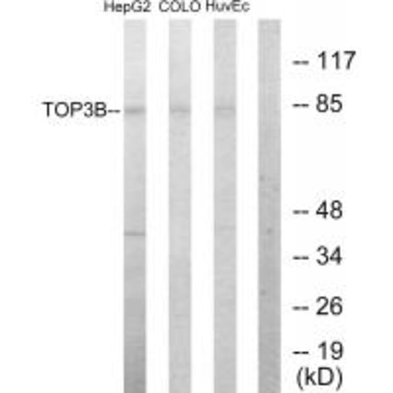 Western blot - TOP3B Antibody from Signalway Antibody (33641) - Antibodies.com