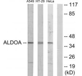 Western blot - ALDOA Antibody from Signalway Antibody (33649) - Antibodies.com