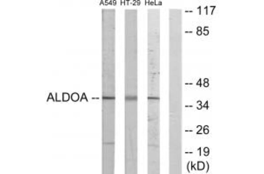 Western blot - ALDOA Antibody from Signalway Antibody (33649) - Antibodies.com
