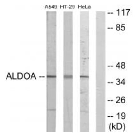 Western blot - ALDOA Antibody from Signalway Antibody (33649) - Antibodies.com