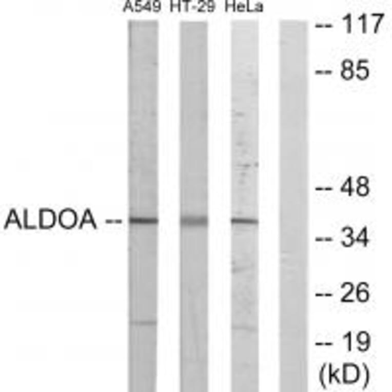 Western blot - ALDOA Antibody from Signalway Antibody (33649) - Antibodies.com