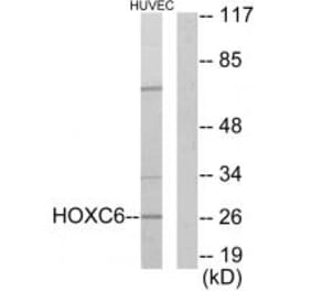 Western blot - HOXC6 Antibody from Signalway Antibody (33662) - Antibodies.com