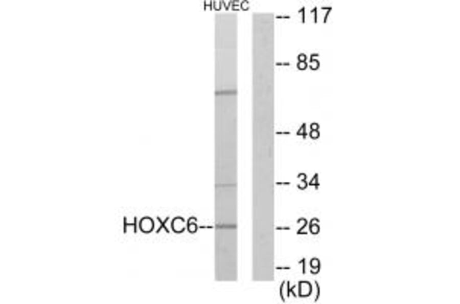 Western blot - HOXC6 Antibody from Signalway Antibody (33662) - Antibodies.com