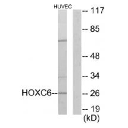 Western blot - HOXC6 Antibody from Signalway Antibody (33662) - Antibodies.com