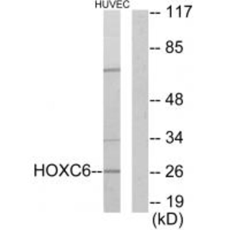 Western blot - HOXC6 Antibody from Signalway Antibody (33662) - Antibodies.com