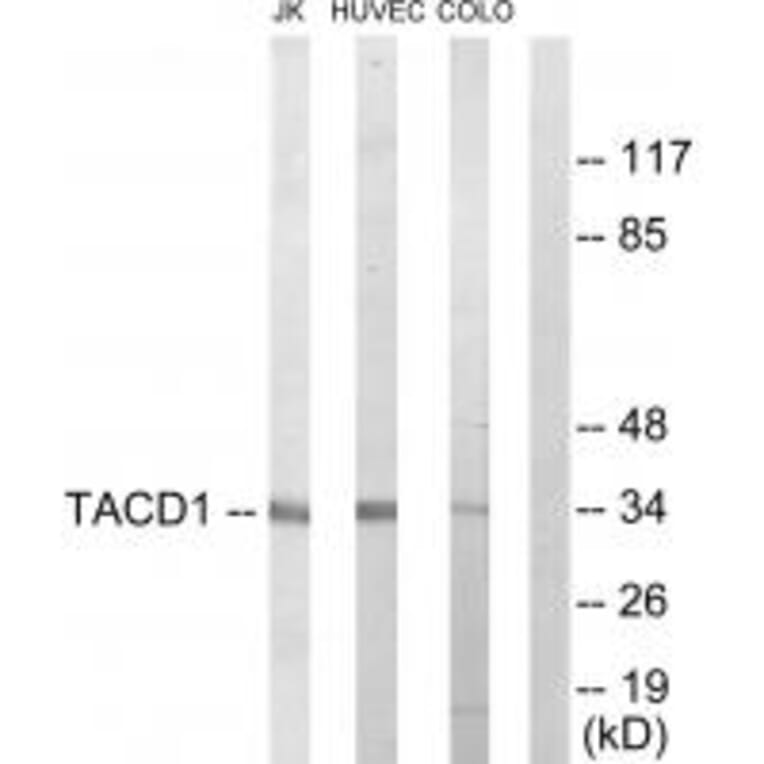 Western blot - TACD1 Antibody from Signalway Antibody (33687) - Antibodies.com