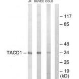 Western blot - TACD1 Antibody from Signalway Antibody (33687) - Antibodies.com