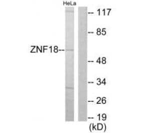 Western blot - ZNF18 Antibody from Signalway Antibody (33689) - Antibodies.com