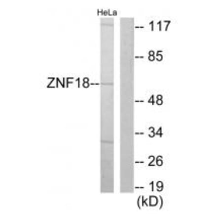 Western blot - ZNF18 Antibody from Signalway Antibody (33689) - Antibodies.com