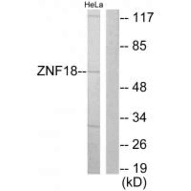Western blot - ZNF18 Antibody from Signalway Antibody (33689) - Antibodies.com