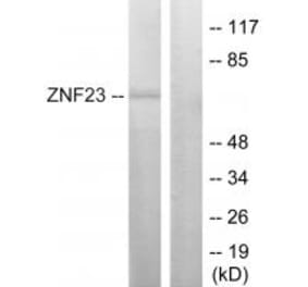 Western blot - ZNF23 Antibody from Signalway Antibody (33690) - Antibodies.com