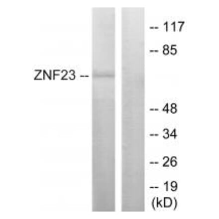Western blot - ZNF23 Antibody from Signalway Antibody (33690) - Antibodies.com