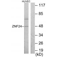 Western blot analysis of extracts from HUVEC cells, using ZNF24 antibody #33691.