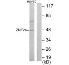 Western blot - ZNF24 Antibody from Signalway Antibody (33691) - Antibodies.com