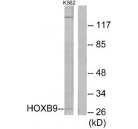 Western blot - HOXB9 Antibody from Signalway Antibody (33693) - Antibodies.com