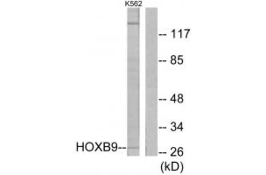 Western blot - HOXB9 Antibody from Signalway Antibody (33693) - Antibodies.com