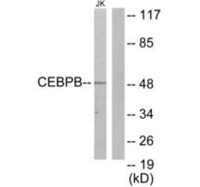 Western blot - CEBPB Antibody from Signalway Antibody (33697) - Antibodies.com