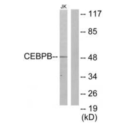 Western blot - CEBPB Antibody from Signalway Antibody (33697) - Antibodies.com