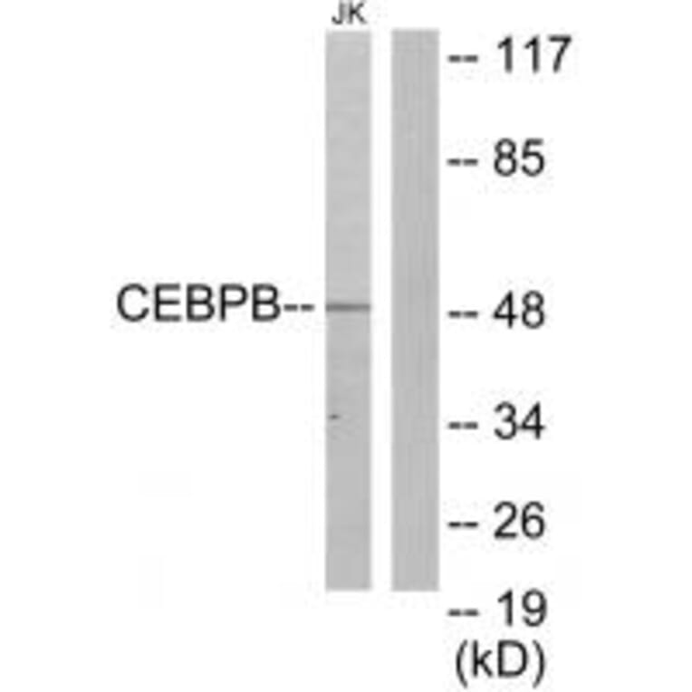 Western blot - CEBPB Antibody from Signalway Antibody (33697) - Antibodies.com