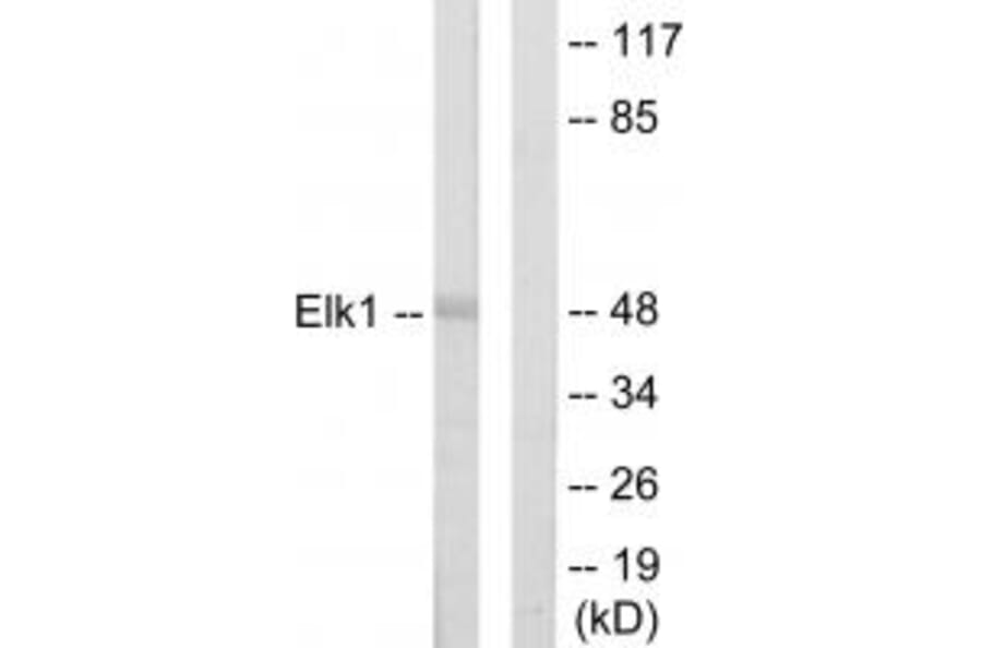 Western blot - Elk1 Antibody from Signalway Antibody (33707) - Antibodies.com