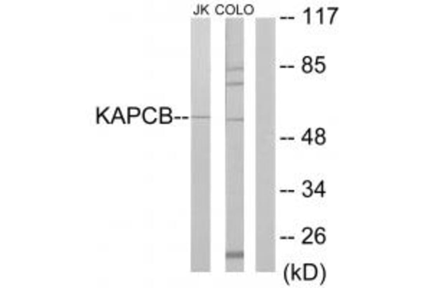 Western blot - KAPCB Antibody from Signalway Antibody (33718) - Antibodies.com