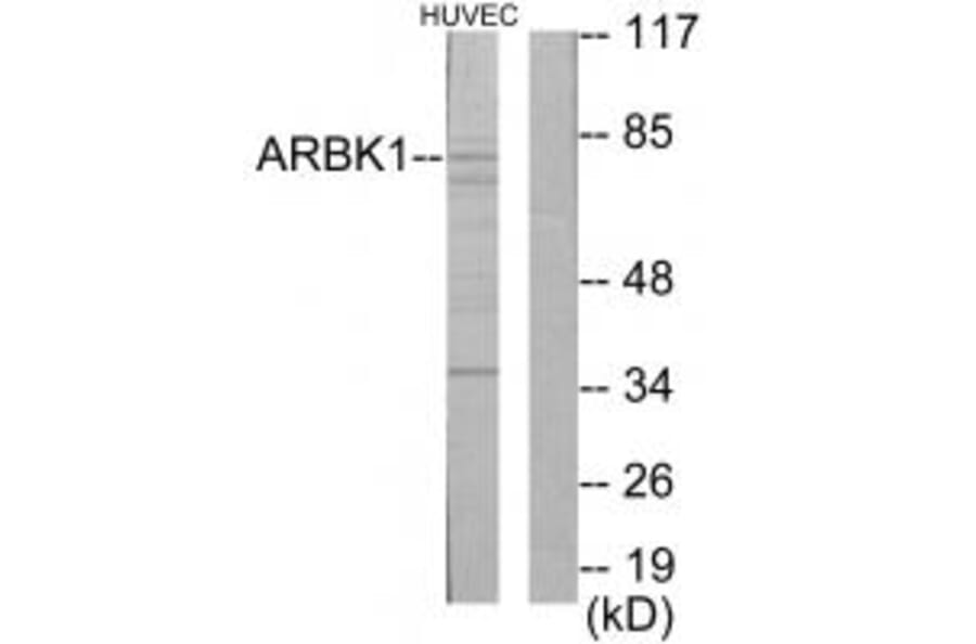 Western blot - ARBK1 Antibody from Signalway Antibody (33725) - Antibodies.com