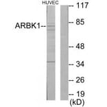 Western blot - ARBK1 Antibody from Signalway Antibody (33725) - Antibodies.com