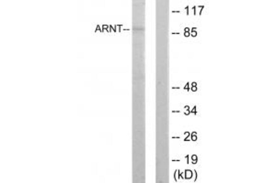 Western blot - ARNT Antibody from Signalway Antibody (33731) - Antibodies.com