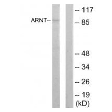 Western blot - ARNT Antibody from Signalway Antibody (33731) - Antibodies.com