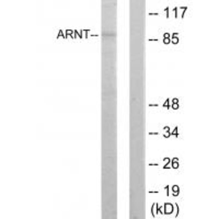Western blot - ARNT Antibody from Signalway Antibody (33731) - Antibodies.com