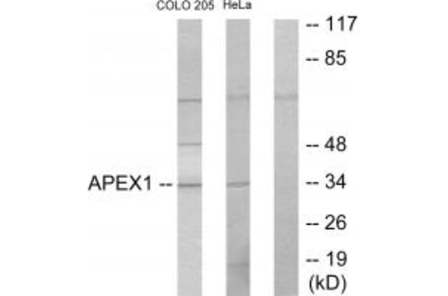 Western blot - APEX1 Antibody from Signalway Antibody (33732) - Antibodies.com