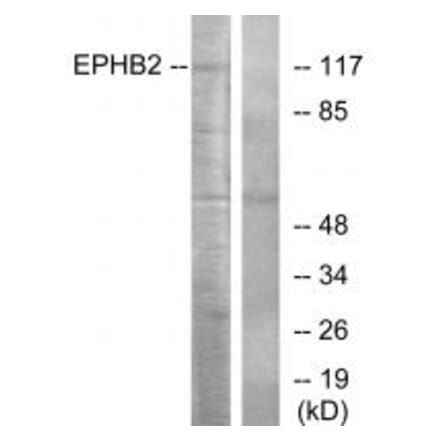 Western blot - EPHB2 Antibody from Signalway Antibody (33741) - Antibodies.com