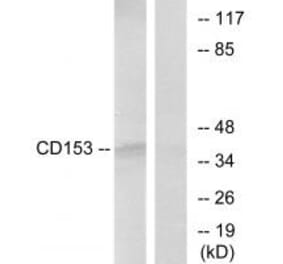 Western blot - CD153 Antibody from Signalway Antibody (33752) - Antibodies.com