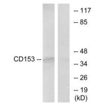 Western blot - CD153 Antibody from Signalway Antibody (33752) - Antibodies.com