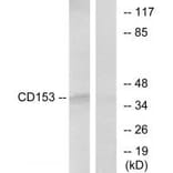 Western blot - CD153 Antibody from Signalway Antibody (33752) - Antibodies.com