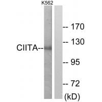 Western blot analysis of extracts from K562 cells, using CIITA antibody #33753.