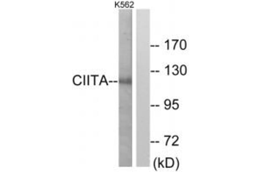 Western blot - CIITA Antibody from Signalway Antibody (33753) - Antibodies.com