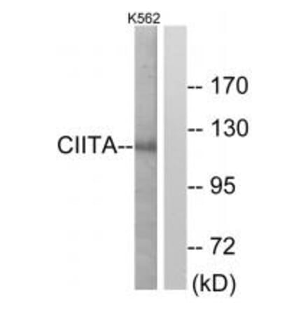 Western blot - CIITA Antibody from Signalway Antibody (33753) - Antibodies.com